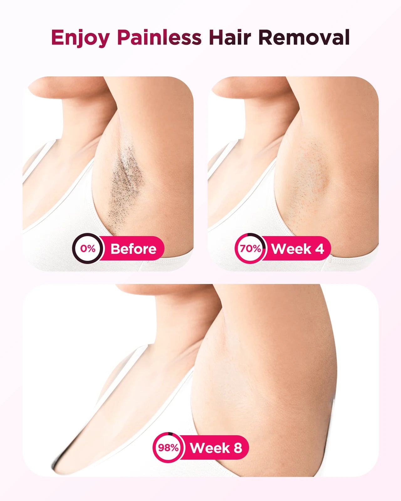 Ice-Cooling IPL Laser Hair Removal